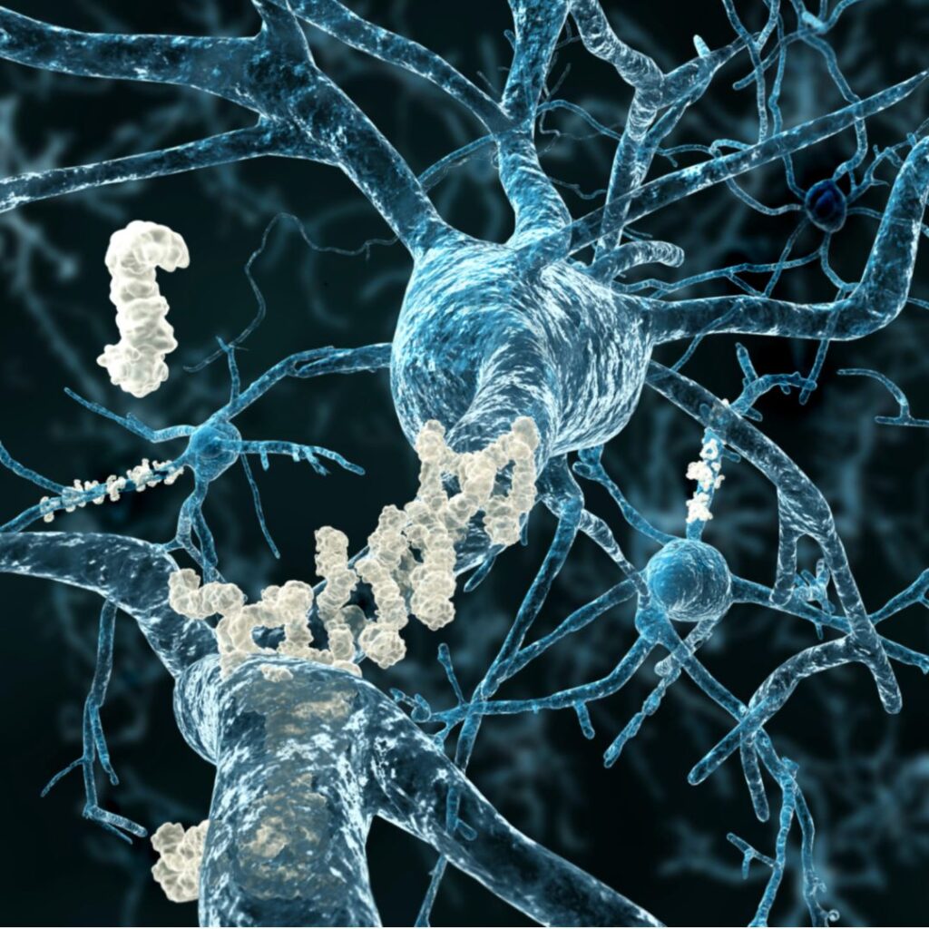 Exemple de protéine qui permet la détection précoce d'Alzheimer